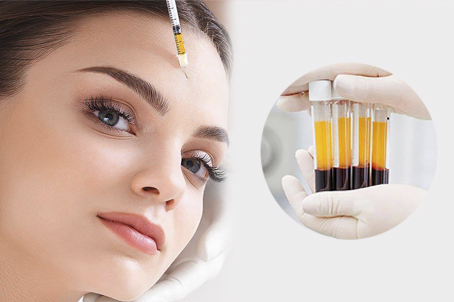 PRP ( Hair & Skin )